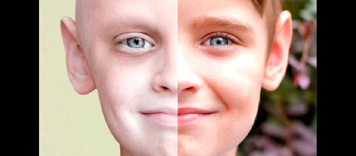 Leucemia Mieloide Croacutenica un caacutencer con buen pronoacutestico