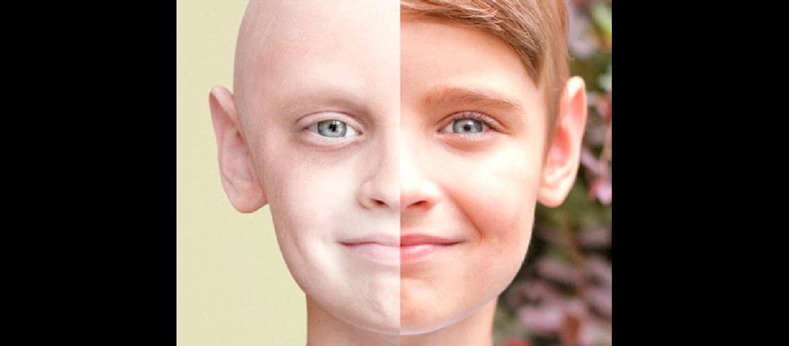 Vivir con leucemia  mieloide croacutenica