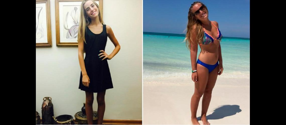 Se hizo viral su lucha contra la anorexia