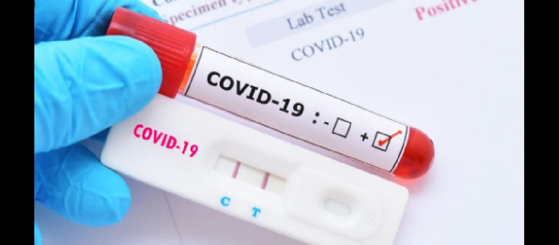 La Anmat aproboacute primer test argentino de diagnoacutestico de Covid-19