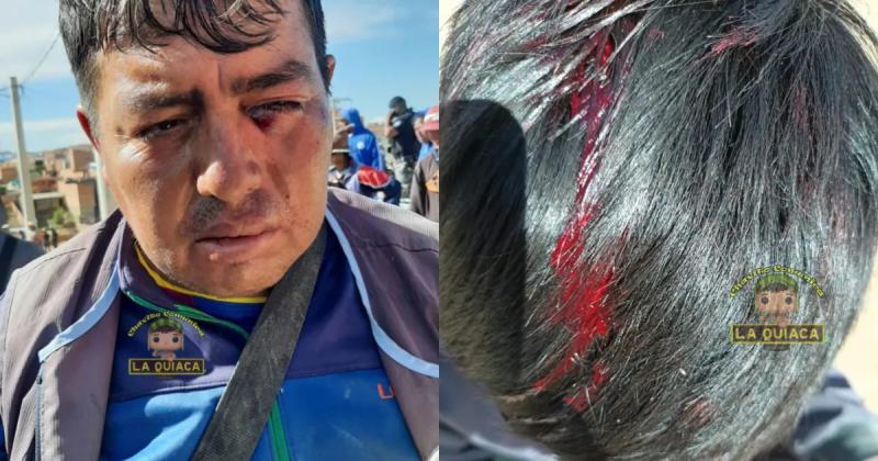 Brutal pelea en la frontera entre carreros de La Quiaca y Villazoacuten