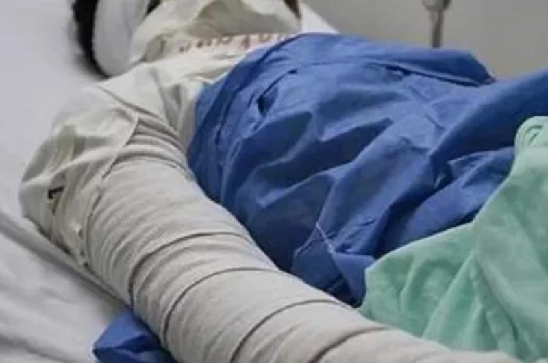 Internaron a una mujer con 80-en-porciento- del cuerpo quemado tras supuesto intento de femicidio