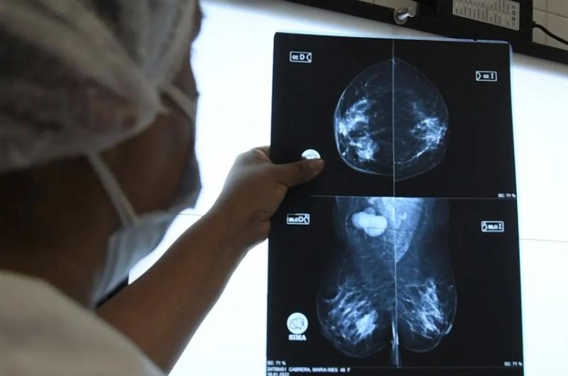 Realizaraacuten mamografiacuteas por demanda espontaacutenea en el Hospital de Humahuaca