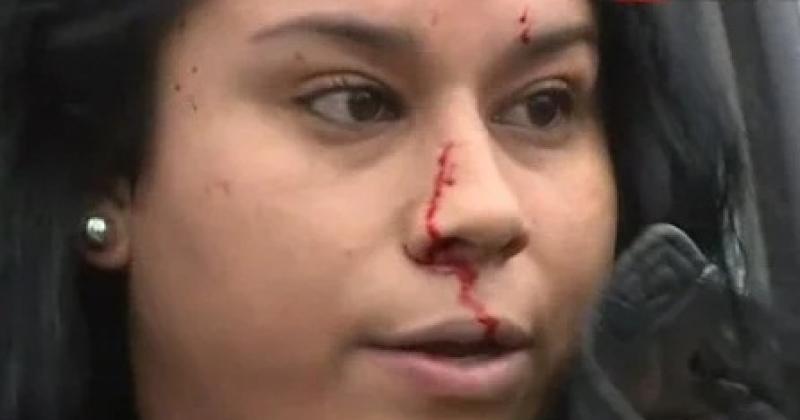 Quien es la mujer que cabeceoacute el vidrio de un patrullero para fingir que fue reprimida