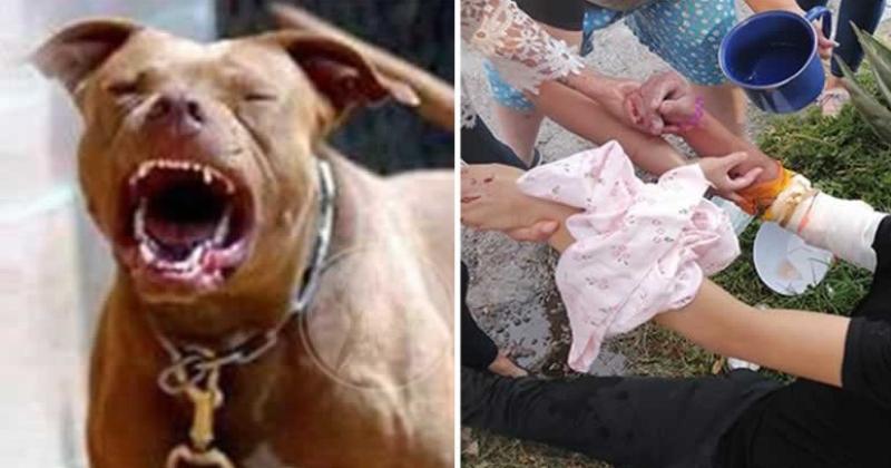 Una joven fue atacada por dos perros pitbull en Alto Comedero y tuvo que ser hospitalizada