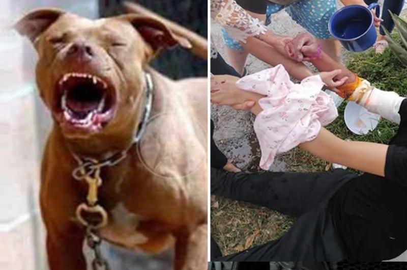 Una joven fue atacada por dos perros pitbull en Alto Comedero y tuvo que ser hospitalizada