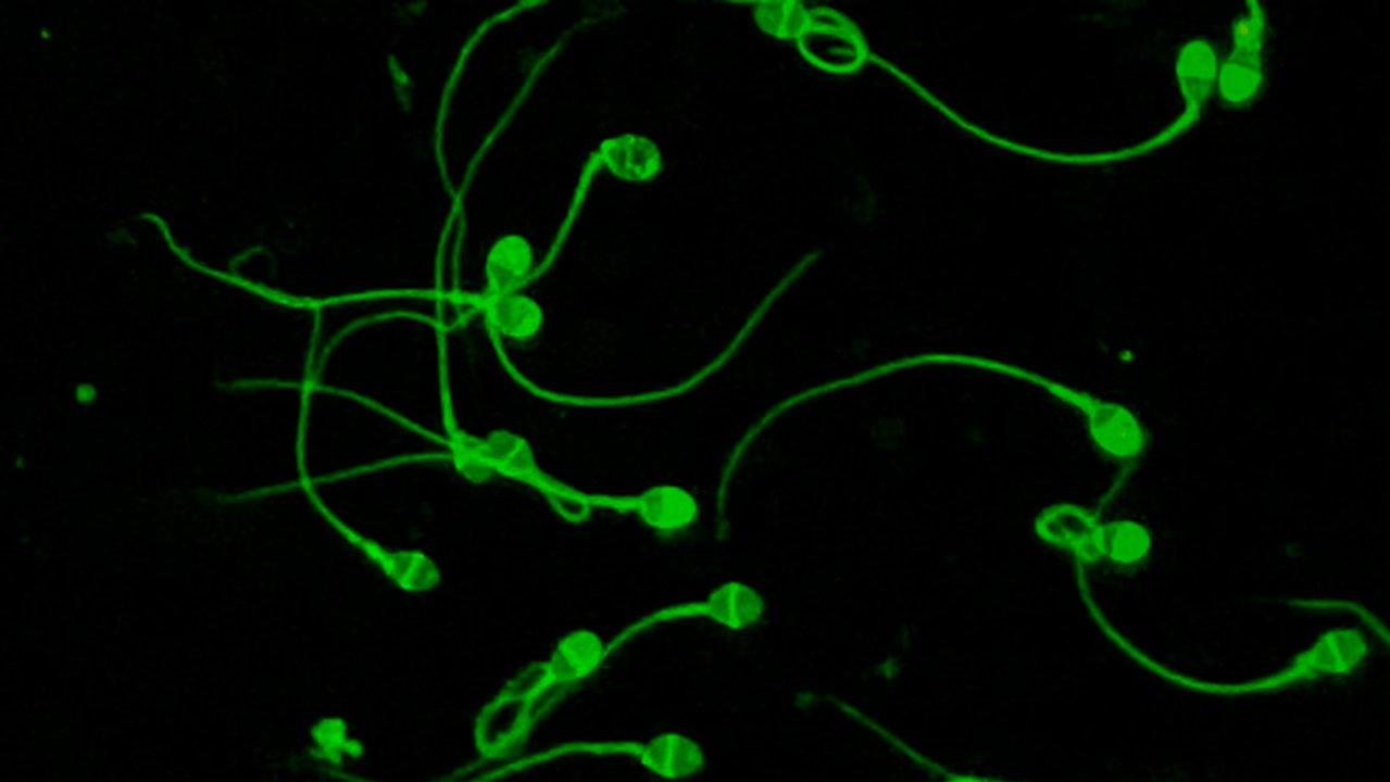 Una tecnologiacutea creada por argentinos aumentoacute las tasas de eacutexito en tratamientos de reproduccioacuten asistida