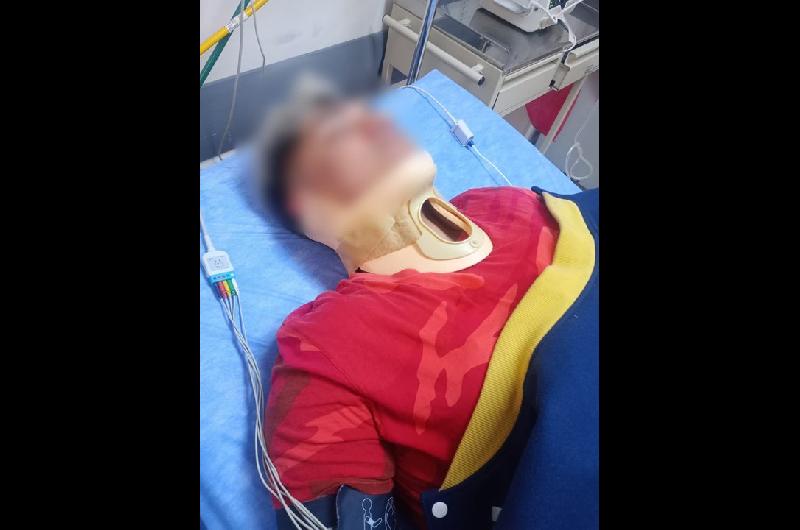 Tras una persecucioacuten detuvieron en Recoleta a un motochorro con antecedentes