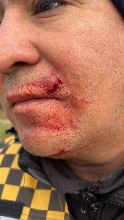 Coacuterdoba- agredioacute a un policiacutea y fue detenido