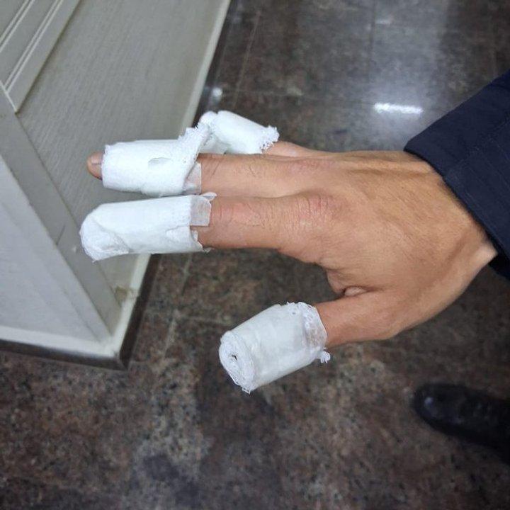 Tres adolescentes quemaron a un policiacutea con una bomba molotov y fueron detenidos en Coacuterdoba