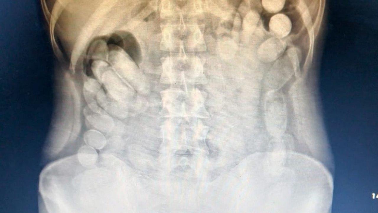 Tucumaacuten- detienen a una pasajera que habiacutea ingerido maacutes de 100 caacutepsulas de cocaiacutena