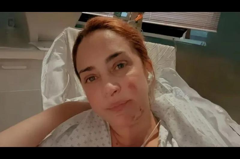 Mariacutea Julia Olivaacuten mostroacute coacutemo quedoacute su brazo tras el terrible accidente con una estufa