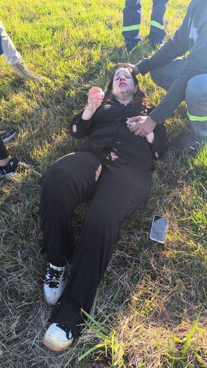 Una diputada libertaria resultoacute con heridas leves al despistarse su auto en la autopista Buenos Aires-Rosario