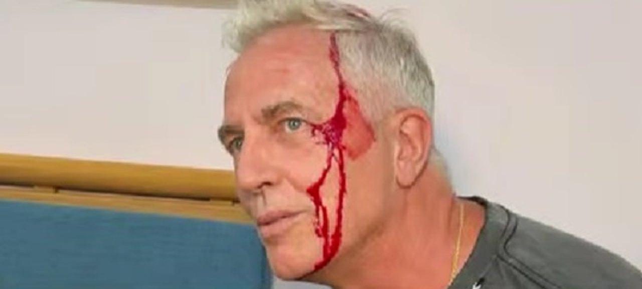 Marley se accidentoacute en Tailandia- Quedeacute chorreando sangre
