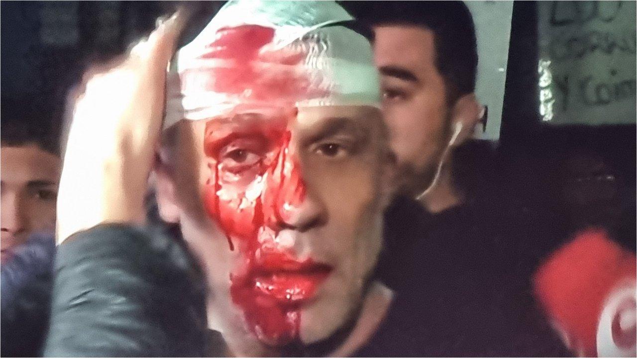 Graviacutesimo- golpearon y le partieron la cara a un periodista de Ameacuterica TV en el acto de Javier Milei en Moreno