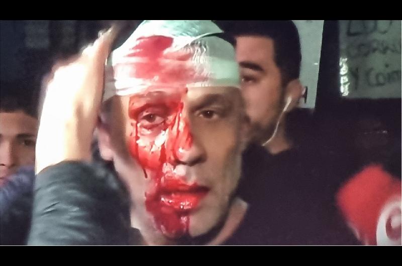 Graviacutesimo- golpearon y le partieron la cara a un periodista de Ameacuterica TV en el acto de Javier Milei en Moreno