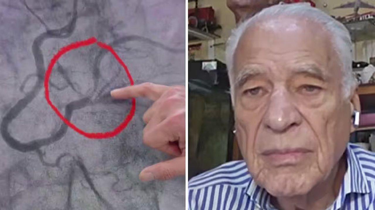 ldquoSe empiezan a morirrdquo- Alberto Cormillot explicoacute el motivo de la cirugiacutea a la que fue sometido