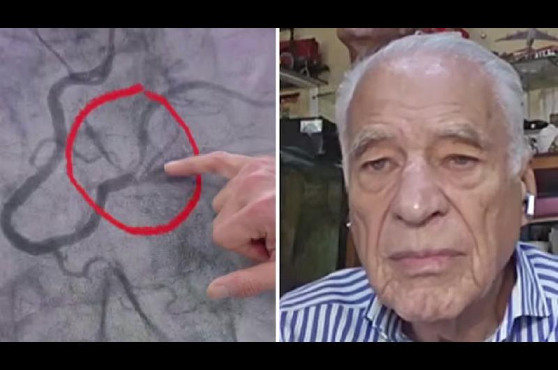 ldquoSe empiezan a morirrdquo- Alberto Cormillot explicoacute el motivo de la cirugiacutea a la que fue sometido