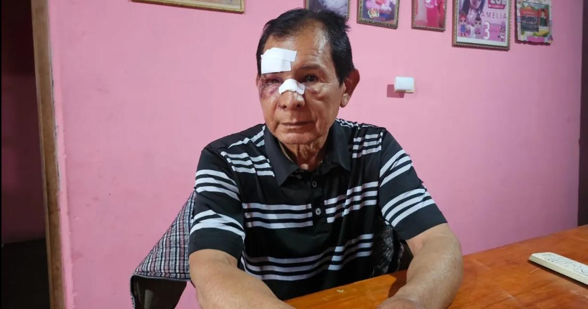 Empleados de un boliche le dieron una brutal golpiza a un hombre de 71 antildeos