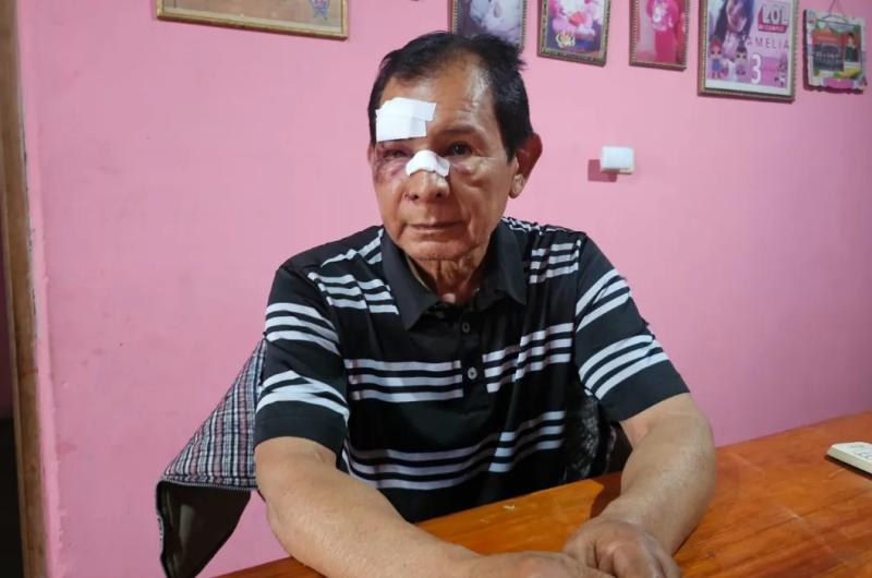 Empleados de un boliche le dieron una brutal golpiza a un hombre de 71 antildeos