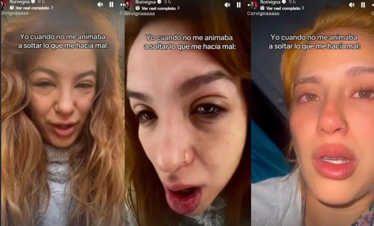Las preocupantes fotos que publicoacute Flor Vigna
