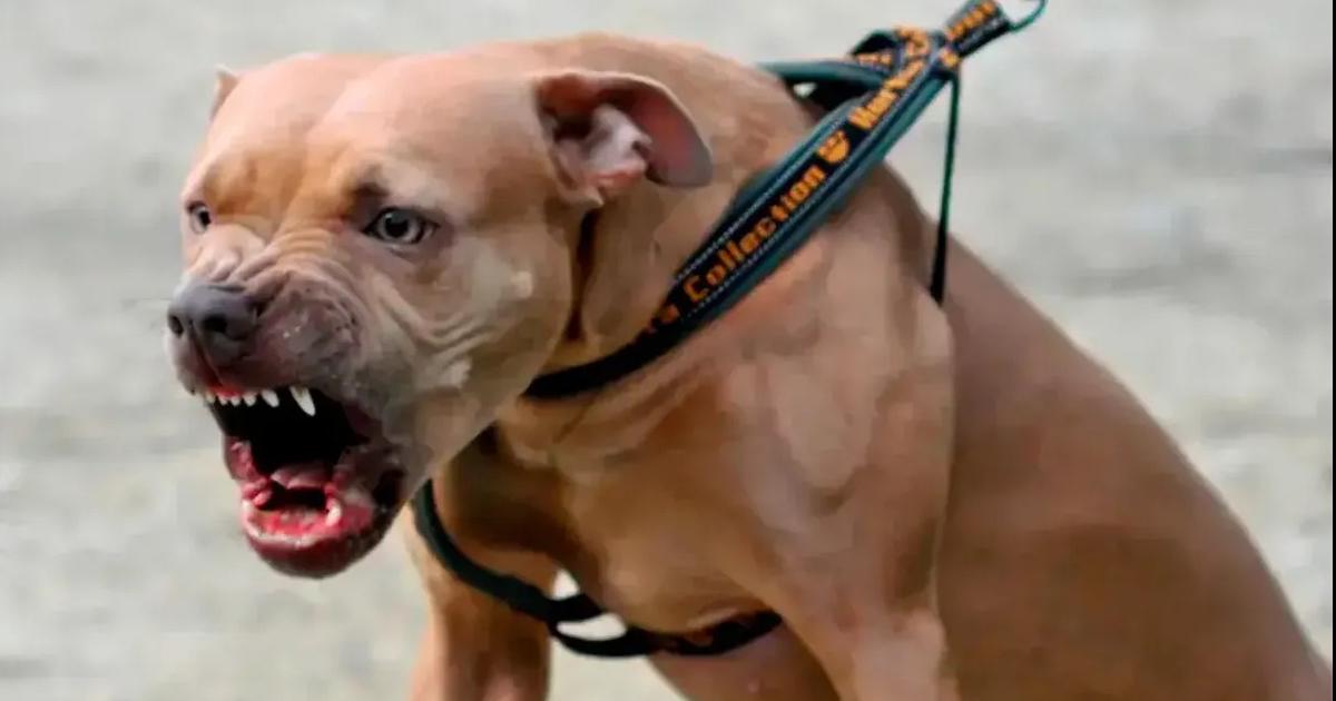 Un hombre sufrioacute graves heridas tras el ataque de un perro pitbull