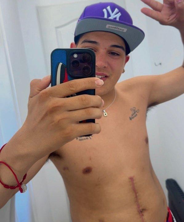 Thiago Medina mostroacute por primera vez sus cicatrices- ldquoMe va a marcar para toda la vidardquo