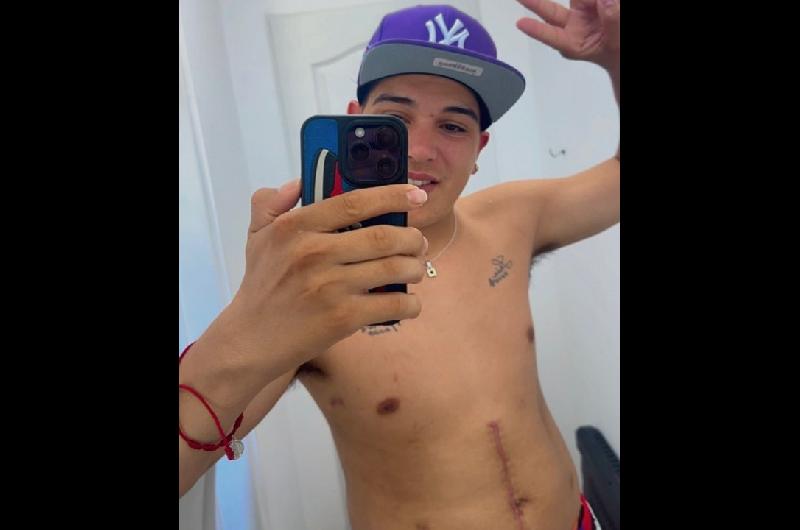 Thiago Medina mostroacute por primera vez sus cicatrices- ldquoMe va a marcar para toda la vidardquo