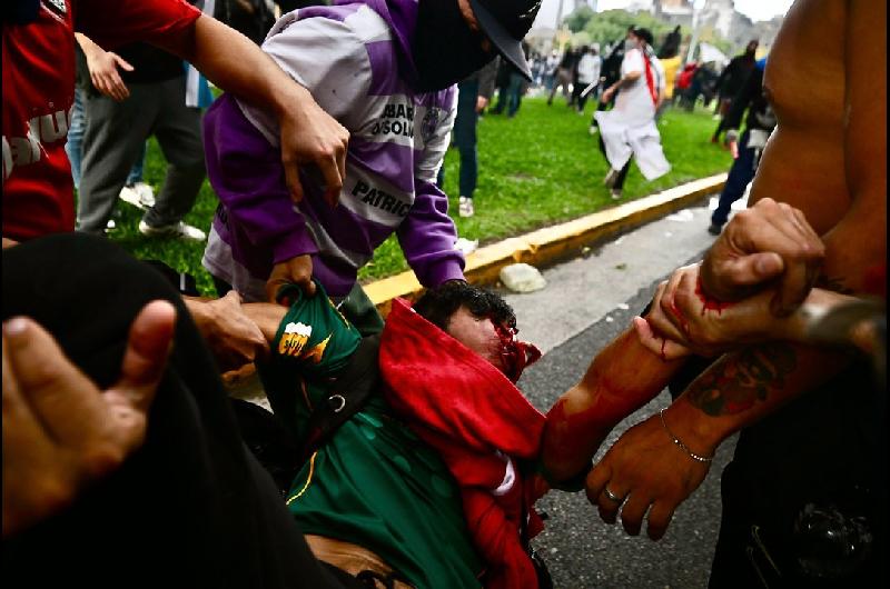 A dos antildeos del protocolo a denuncian maacutes de 2500 heridos y un retroceso en el derecho a la protesta