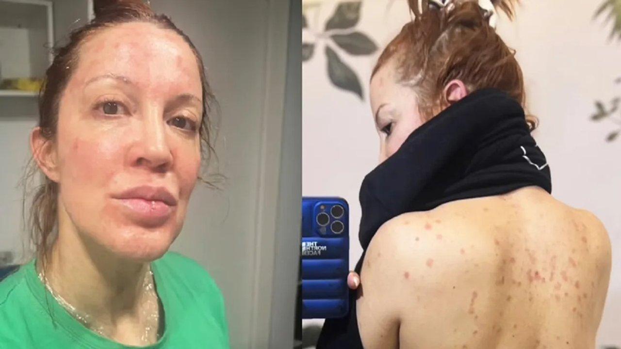 La impactante confesioacuten de Miriam Lanzoni- Me costaba mirarme