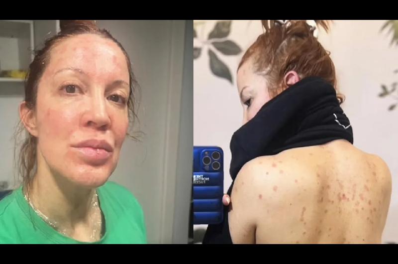 La impactante confesioacuten de Miriam Lanzoni- Me costaba mirarme