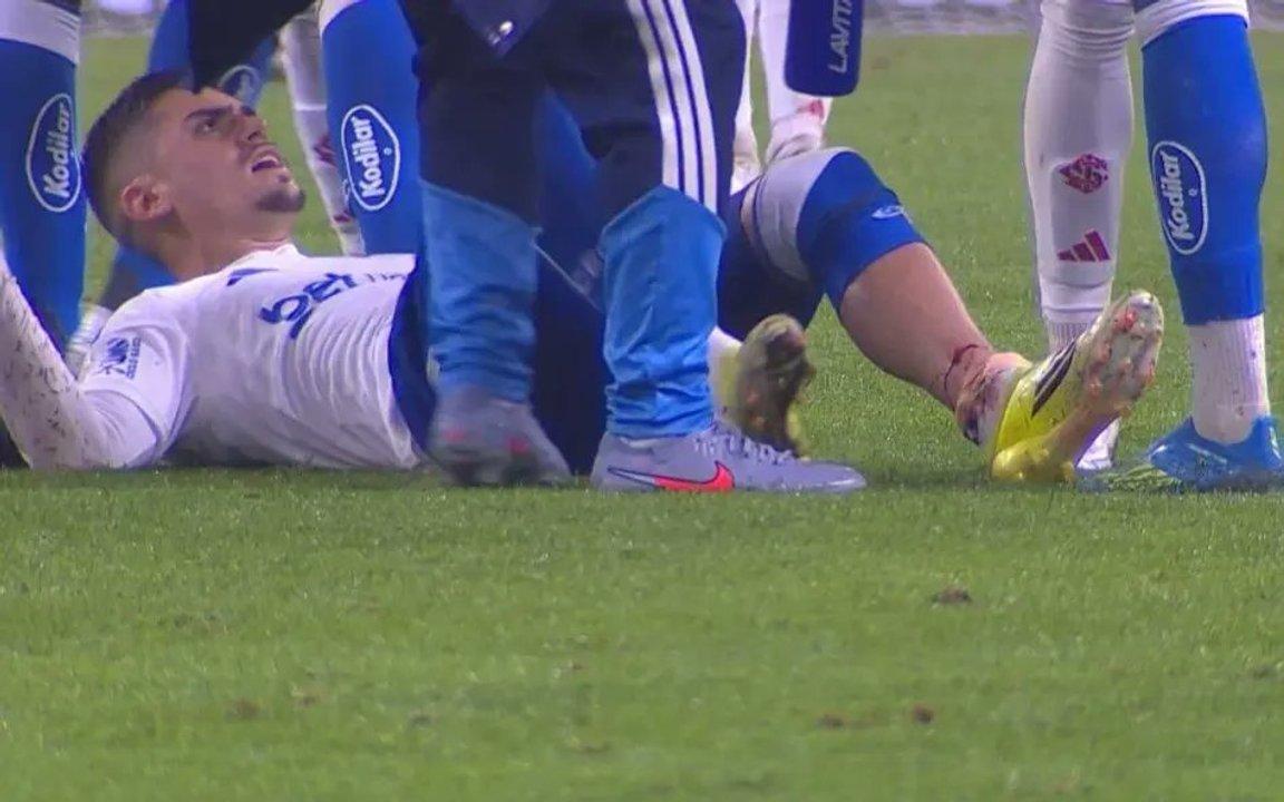 IMAacuteGENES SENSIBLES- la impactante lesioacuten que sufrioacute un futbolista en Brasil