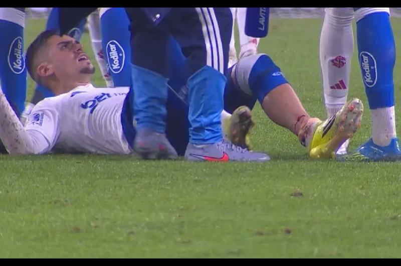 IMAacuteGENES SENSIBLES- la impactante lesioacuten que sufrioacute un futbolista en Brasil