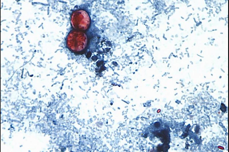Reportan las primeras dos muertes por brote de ciclosporiasis en Estados Unidos