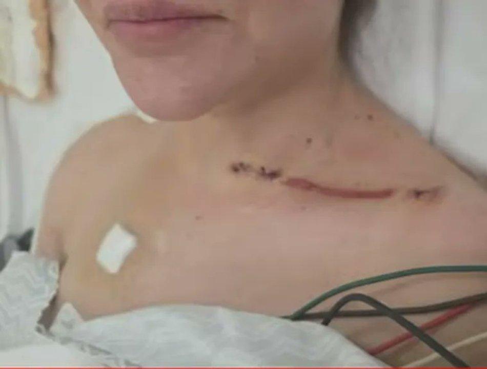 Las nuevas fotos de las heridas de la ex pareja de Cerimedo- rdquoQue Dios te perdone Fernando