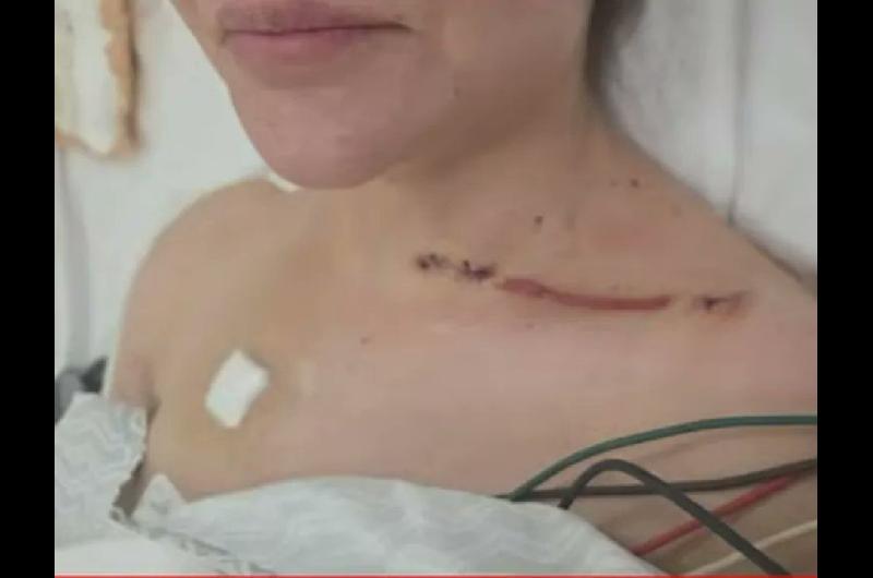 Las nuevas fotos de las heridas de la ex pareja de Cerimedo- rdquoQue Dios te perdone Fernando